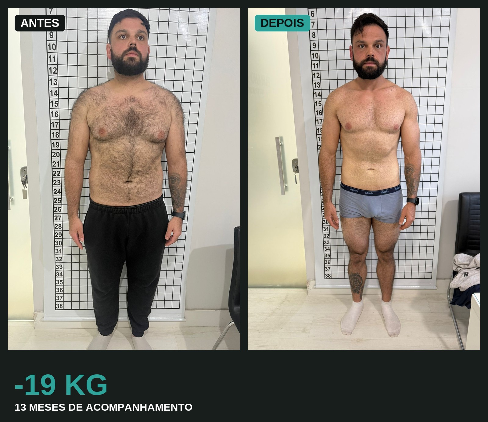 Comparativo antes e depois de paciente com perda de peso e ganho de massa muscular