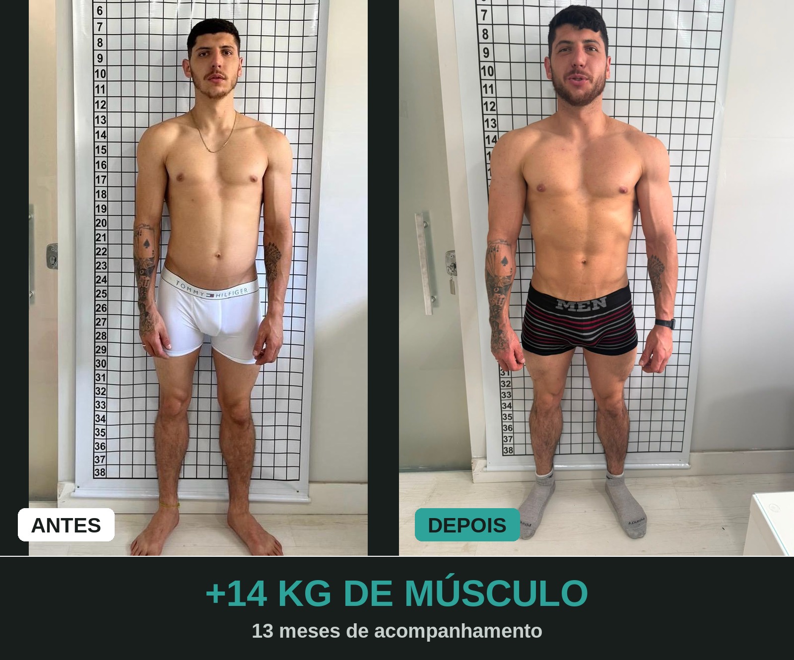 Comparativo antes e depois de paciente com ganho de massa muscular