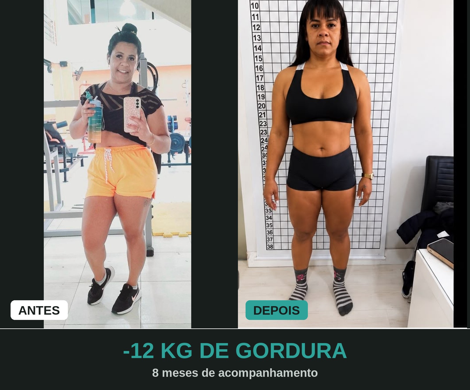 Comparativo antes e depois de paciente mulher com perda de gordura