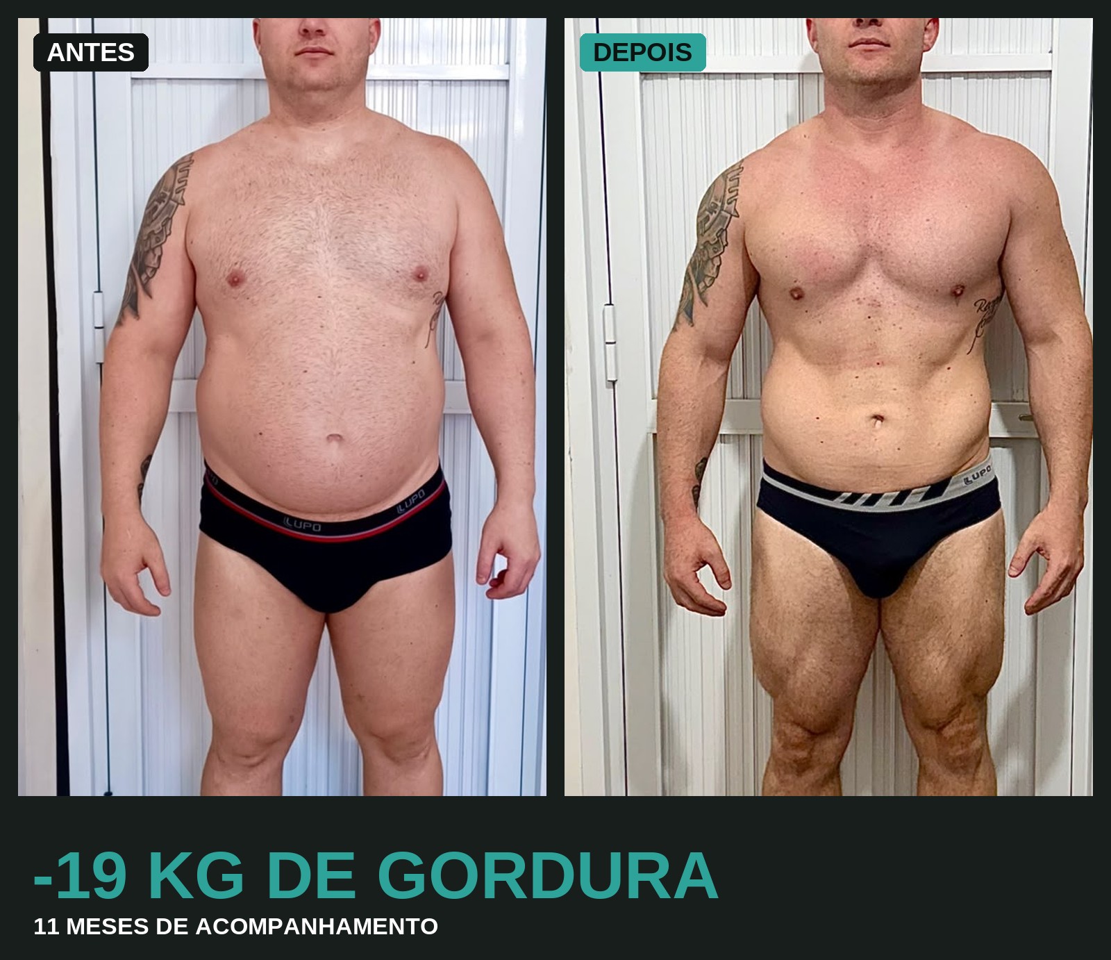 Comparativo antes e depois de paciente com perda de gordura e ganho de massa muscular
